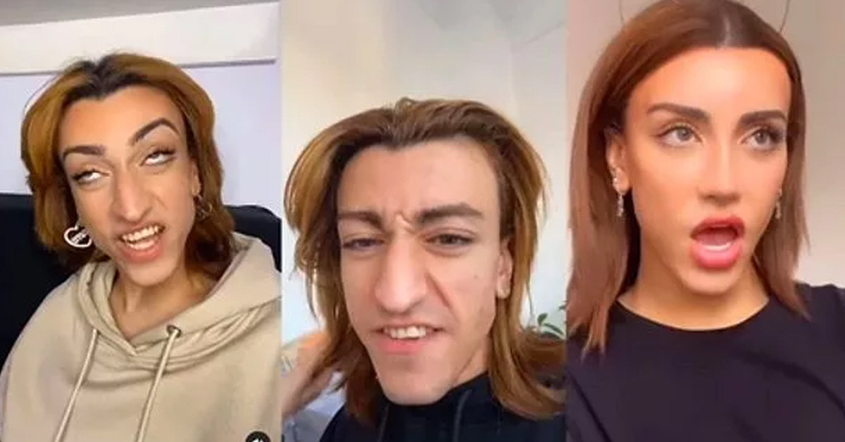 Estetik operasyonları geçirdi