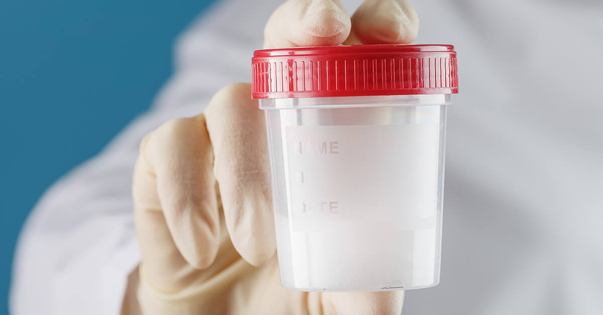 Donör sperm nasıl seçilir