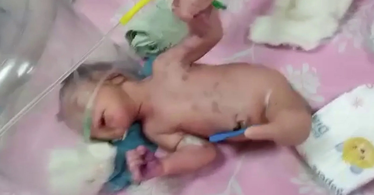 Başka bir hastaneye sevk edildi