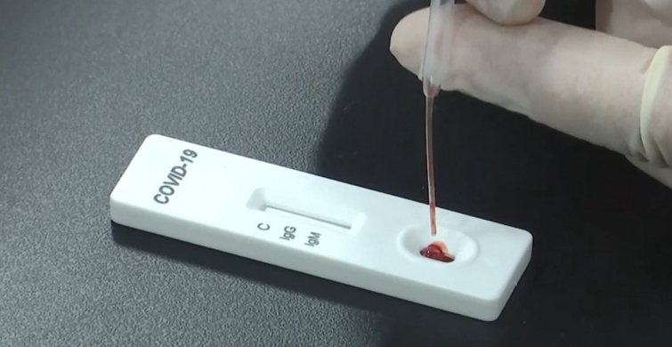 İMMÜN PLAZMA İLE ORTAYA KONULABİLİR