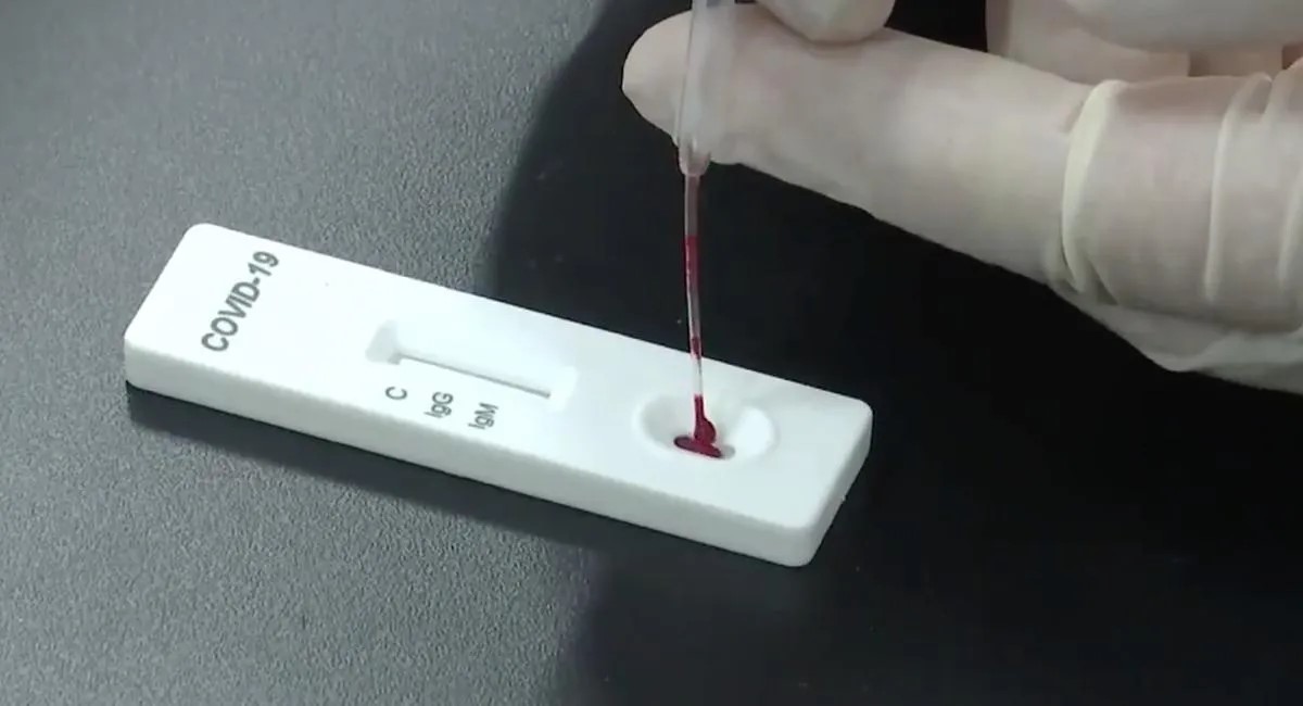 ‘PCR'a Göre Çok Çok Ucuz’