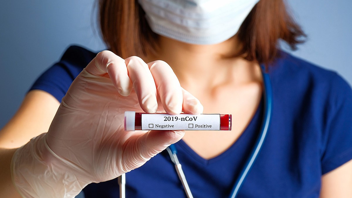 ‘Virüsün Varlığı ya da Yokluğunun Tespitine Dayanıyor’