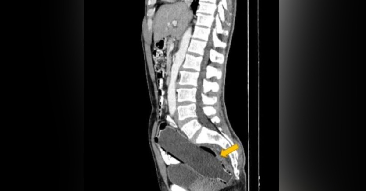 Karısından gizledi