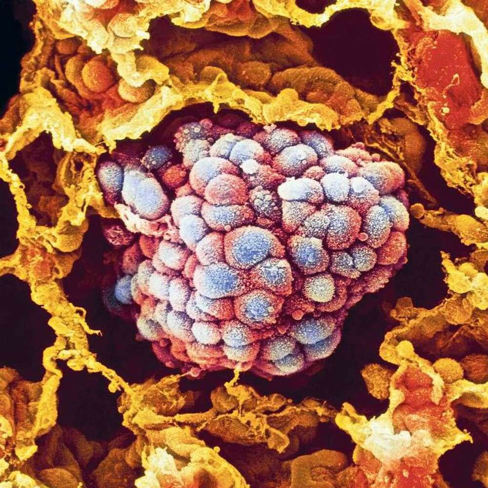  HOMOJEN DEĞİŞİM VAR