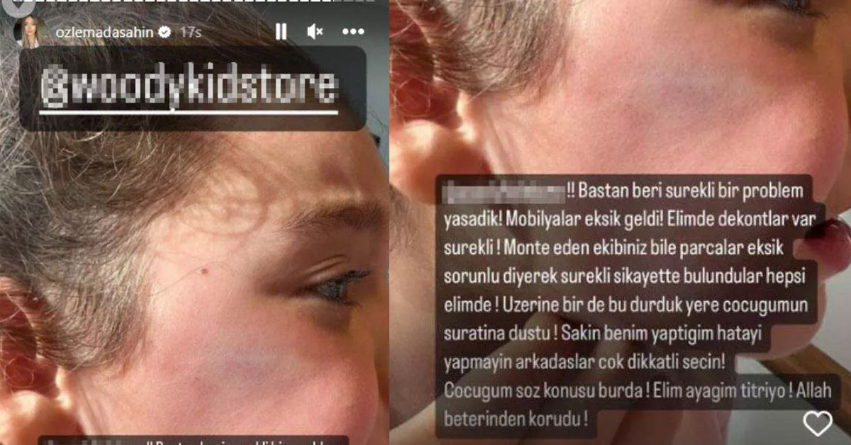 Berkay Şahin'in kızı kaza geçirdi