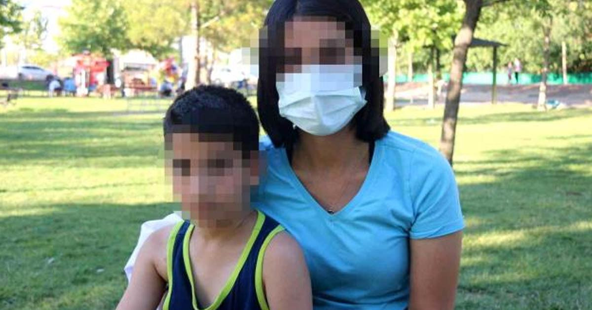 Vücudunda sigara yanıkları gördü