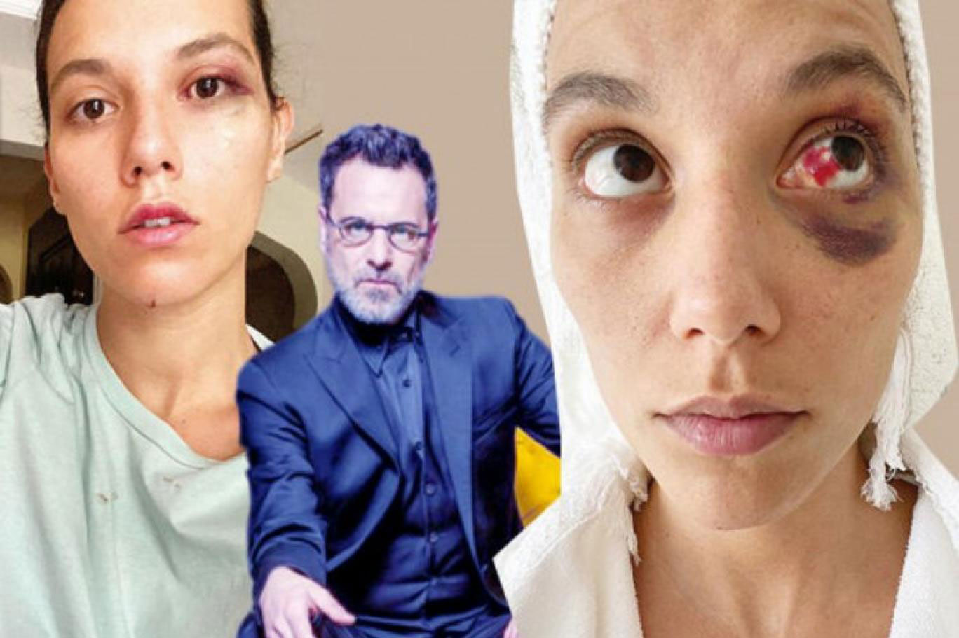 OZAN GÜVEN’İN DENİZ BULUTSUZ’U DARPETMESİ