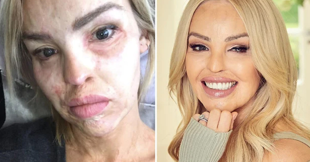 Hikayesi yürekleri burktu