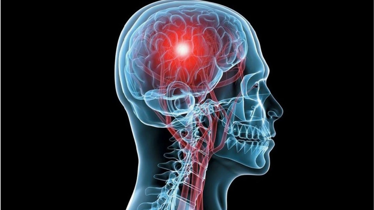 Bağışıklık Sistemi Sinir Hücrelerini Koruyan Yapıya Saldırıyor