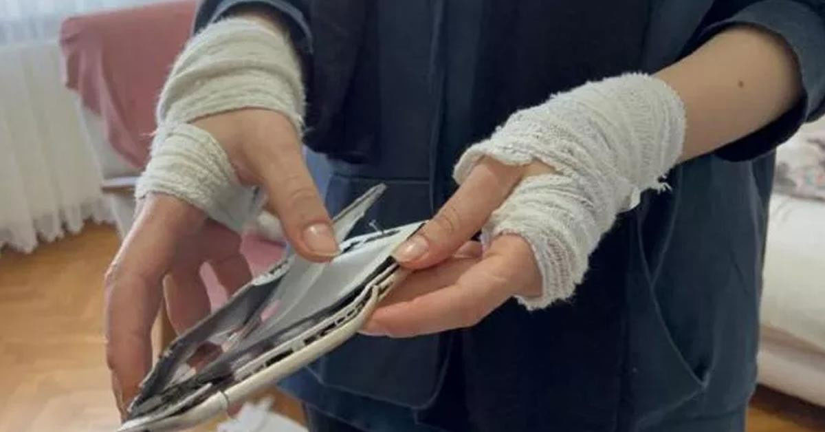 Sakarya'da dayak yiyen kadın kabusu yaşadı