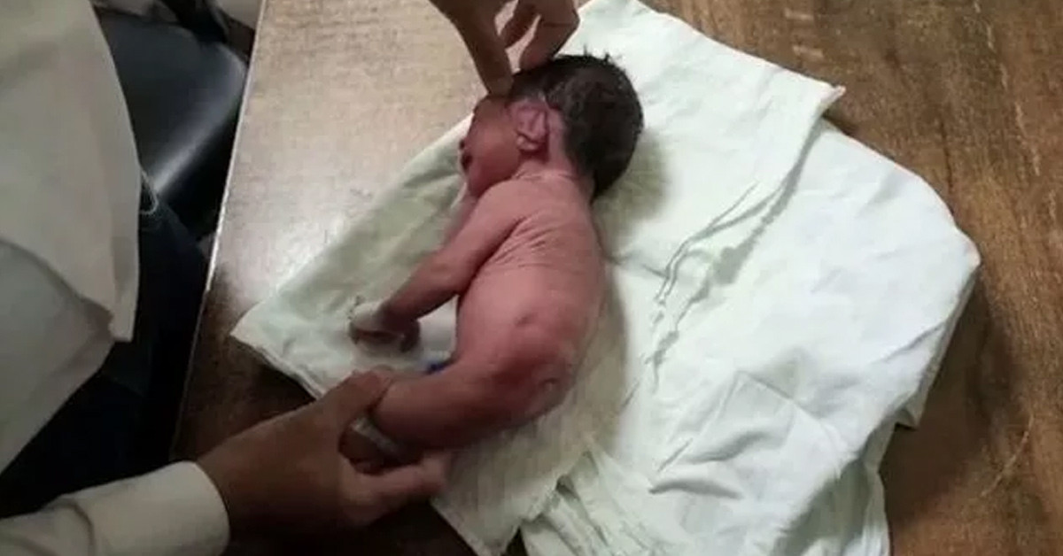 Şaşkına döndüler