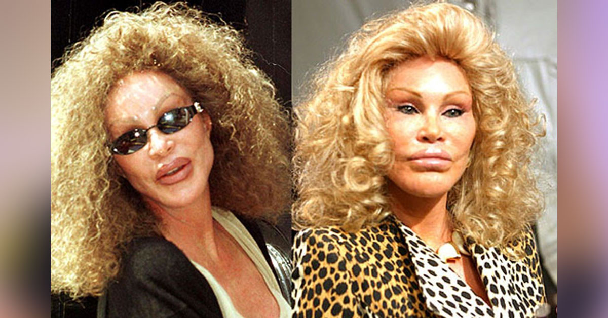 Jocelyn Wildenstein
