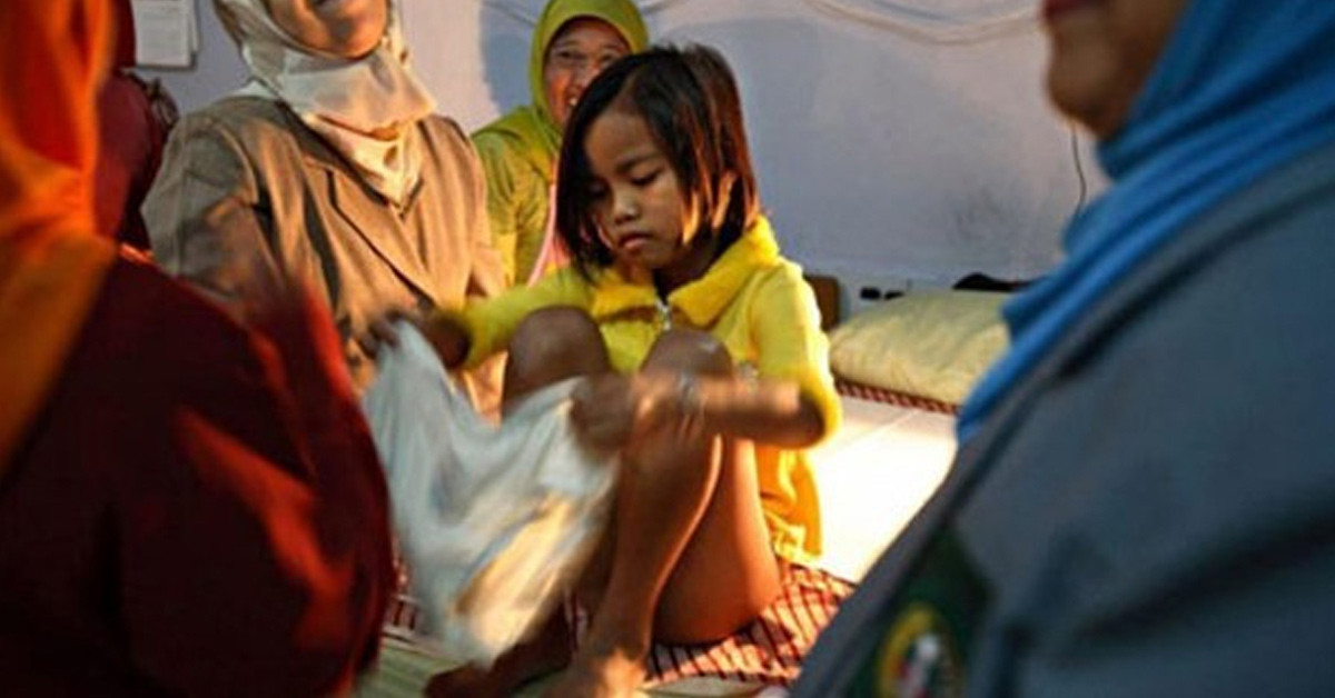 Organın bir kısmının alınması