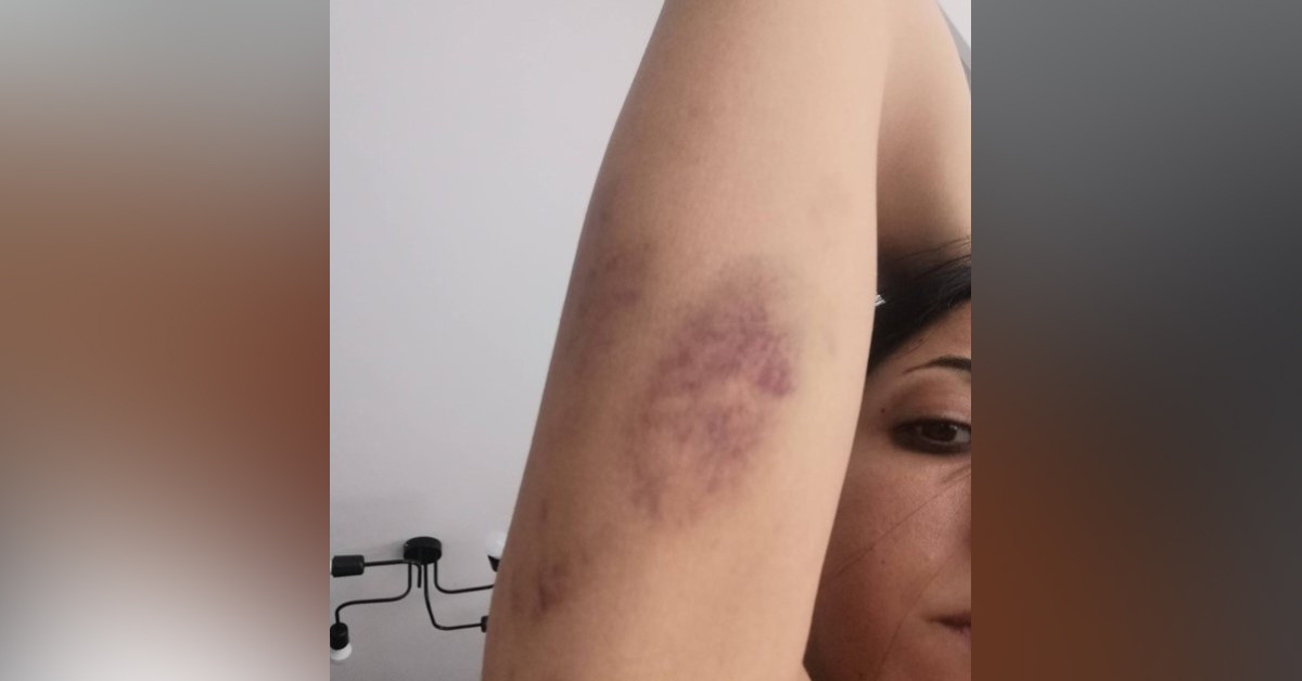 İntihara kalkıştı