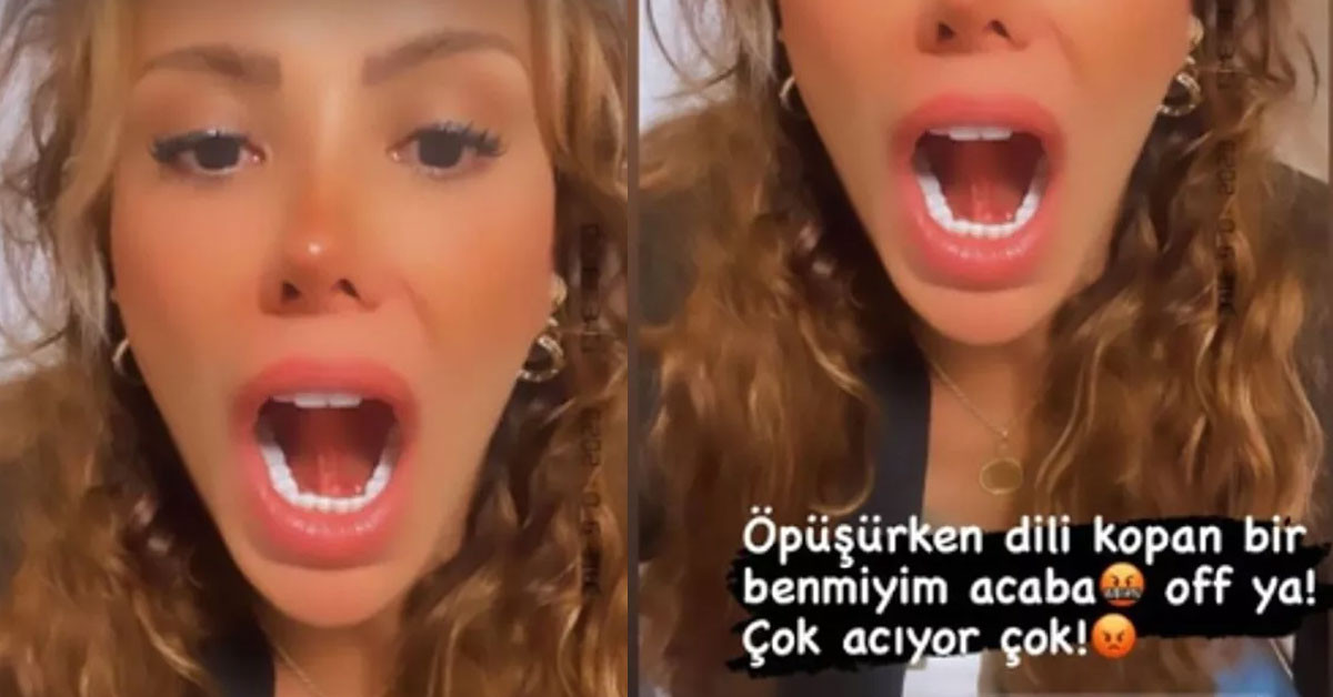 Ceyda Ersoy'un öpüşürken dili koptu