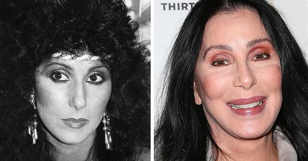 Cher