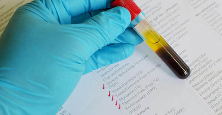 Tiroit Testlerini Yaptırın