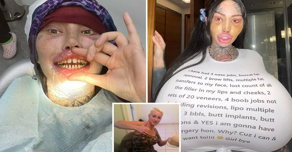 Estetikler yaptırdı