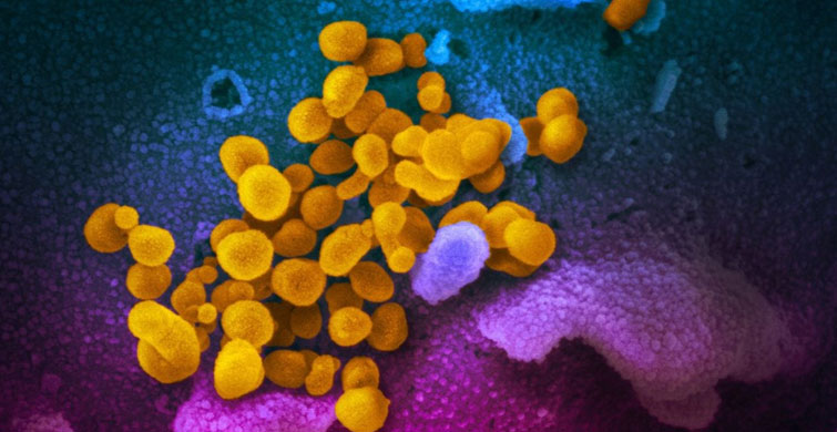 CORONAVİRÜSÜN EN NET GÖRÜNTÜLERİ