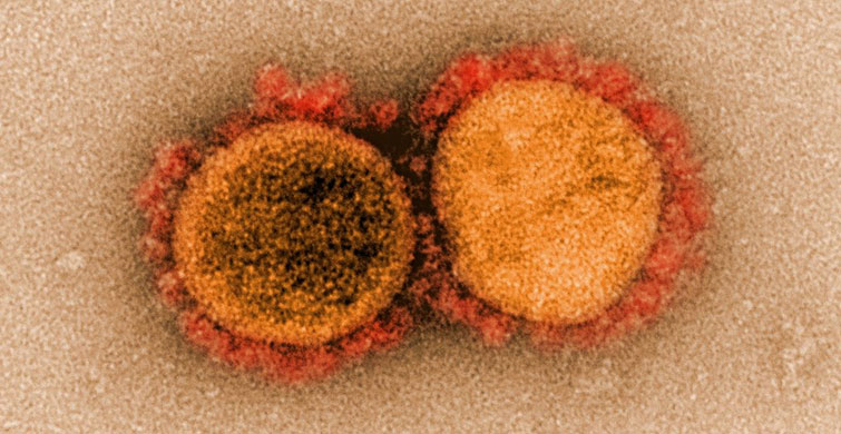 VİRÜSE ADINI VEREN YAPILAR