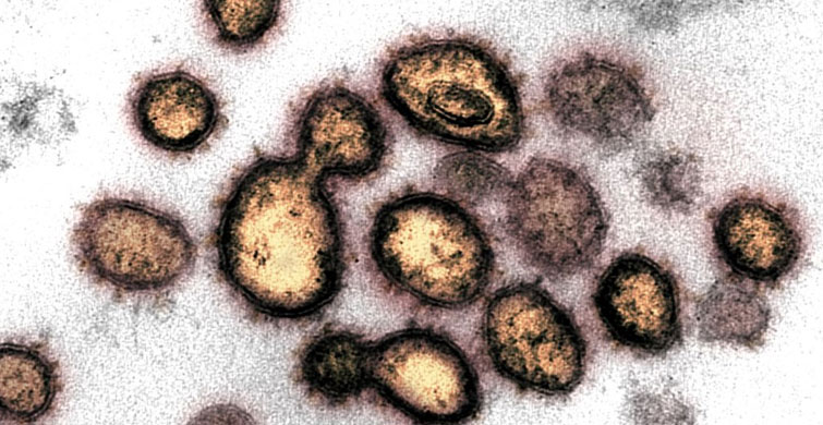 CAN KAYBI 10 BİNİ GEÇTİ