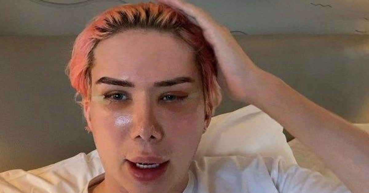  ESTETİĞE 200 BİN STERLİN HARCADI