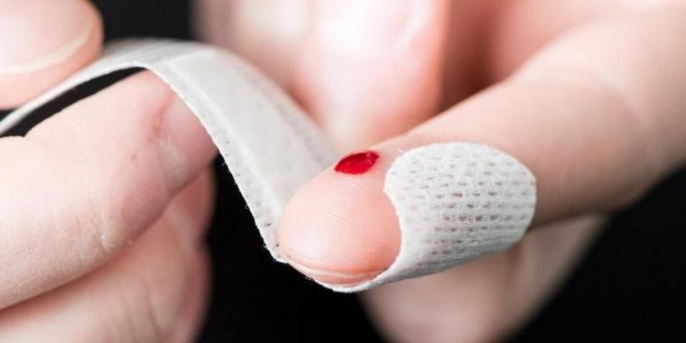 Yaraların Geç İyileşir 