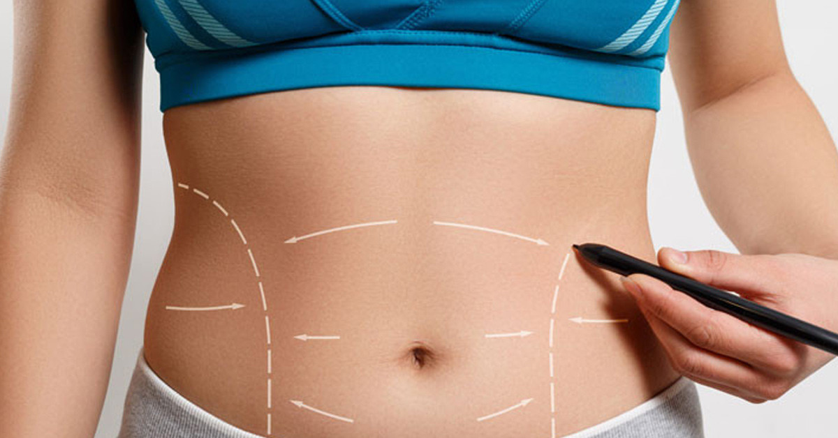 Karın Bölgesindeki Değişiklikler