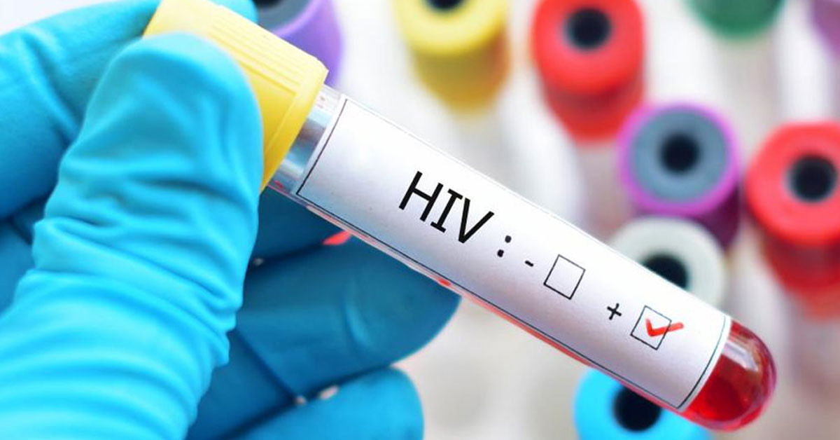 HIV nasıl bulaşır?