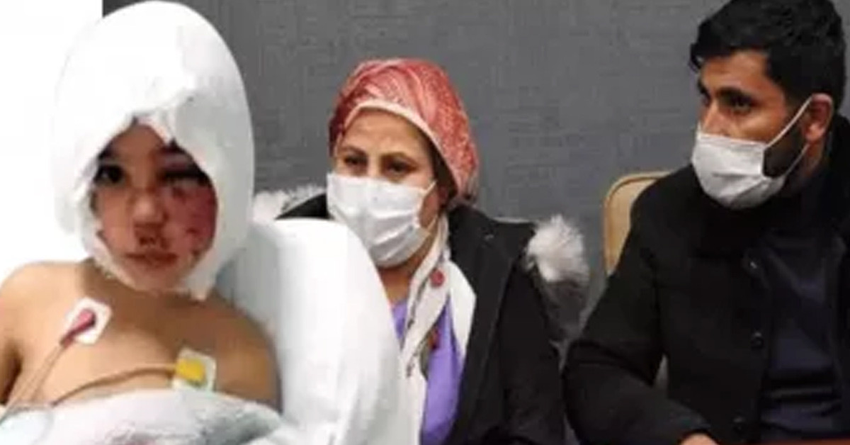 Pitbull saldırısına uğrayan asinin babası işsiz kaldı
