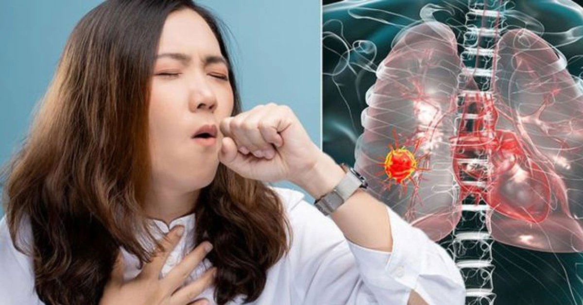 Akciğer kanserine sigaranın zararları Akciğer kanserine sigaranın zararları