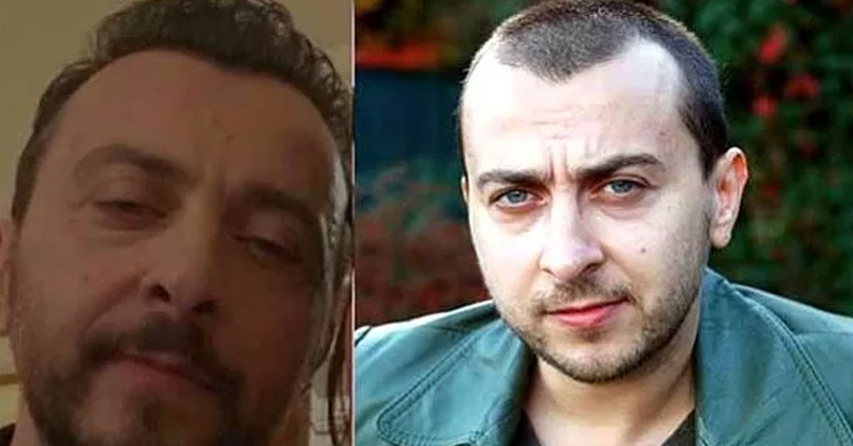 Ali Atay saç ektirdi