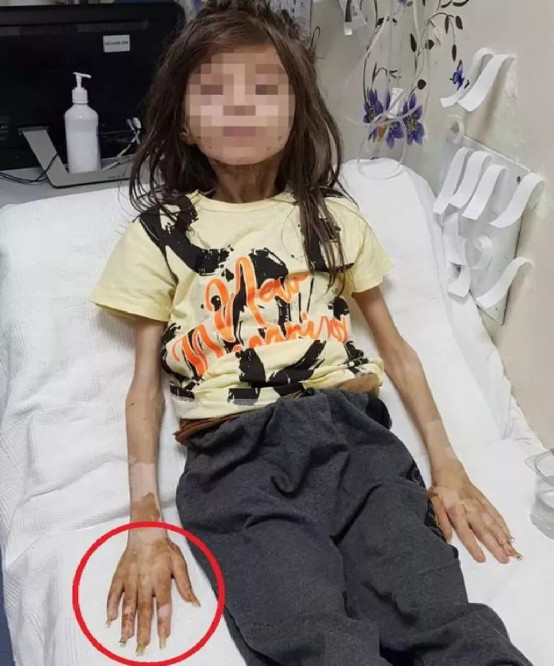 Bursa çöp ev Bursa çöp ev