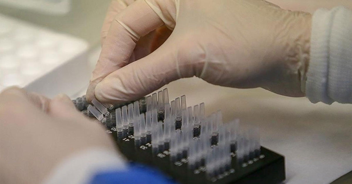 Dünya Sağlık Örgütü (DSÖ), yeni bir tehlikenin kapıda olduğunu belitti. Buna göre, dünya genelinde hepatit B ve C enfeksiyonları nedeniyle her gün 3 bin 500 kişinin yaşamını yitirdiğini bilgisini paylaştı. Dünya Sağlık Örgütü (DSÖ), yeni bir tehlikenin kapıda olduğunu belitti. Buna göre, dünya genelinde hepatit B ve C enfeksiyonları nedeniyle her gün 3 bin 500 kişinin yaşamını yitirdiğini bilgisini paylaştı.
