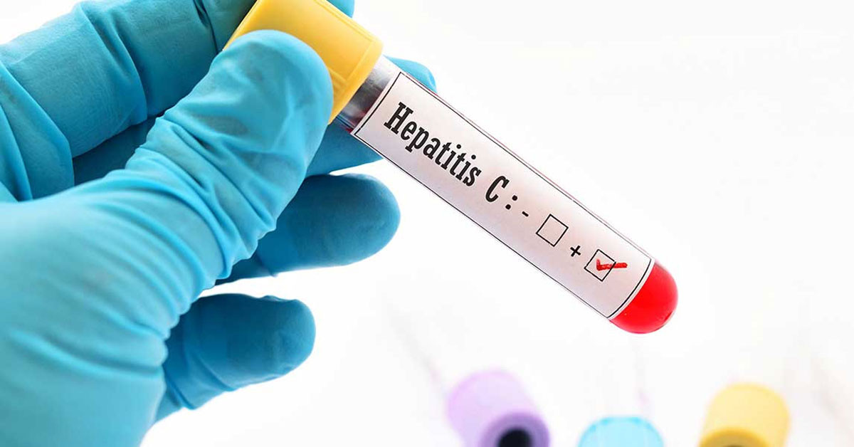 Dünya Sağlık Örgütü (DSÖ), yeni bir tehlikenin kapıda olduğunu belitti. Buna göre, dünya genelinde hepatit B ve C enfeksiyonları nedeniyle her gün 3 bin 500 kişinin yaşamını yitirdiğini bilgisini paylaştı. Dünya Sağlık Örgütü (DSÖ), yeni bir tehlikenin kapıda olduğunu belitti. Buna göre, dünya genelinde hepatit B ve C enfeksiyonları nedeniyle her gün 3 bin 500 kişinin yaşamını yitirdiğini bilgisini paylaştı.