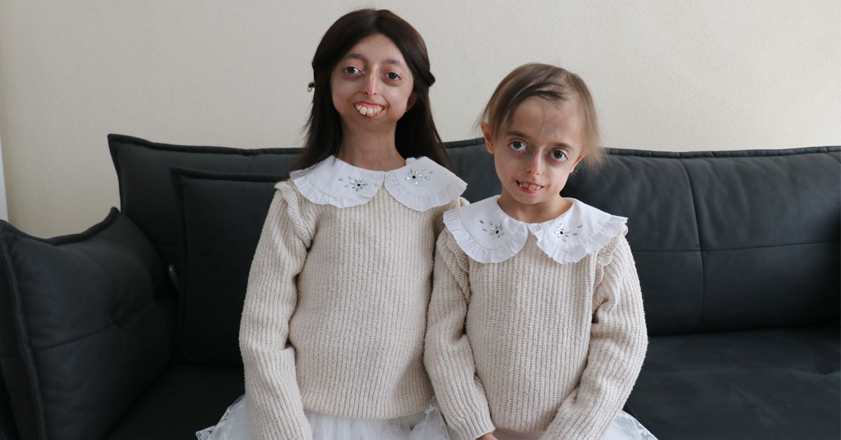 Dünyada nadir olarak görülen bir genetik hastalık olan ‘erken yaşlanma’ (progeria) hastalığıyla mücadele eden, Yalavo’da yaşamlarını sürdüren İremsu ve Zeynep Arslan kardeşler, annelerinin önemli desteği sayesinde hayata daha umutla bakıyorlar Dünyada nadir olarak görülen bir genetik hastalık olan ‘erken yaşlanma’ (progeria) hastalığıyla mücadele eden, Yalavo’da yaşamlarını sürdüren İremsu ve Zeynep Arslan kardeşler, annelerinin önemli desteği sayesinde hayata daha umutla bakıyorlar