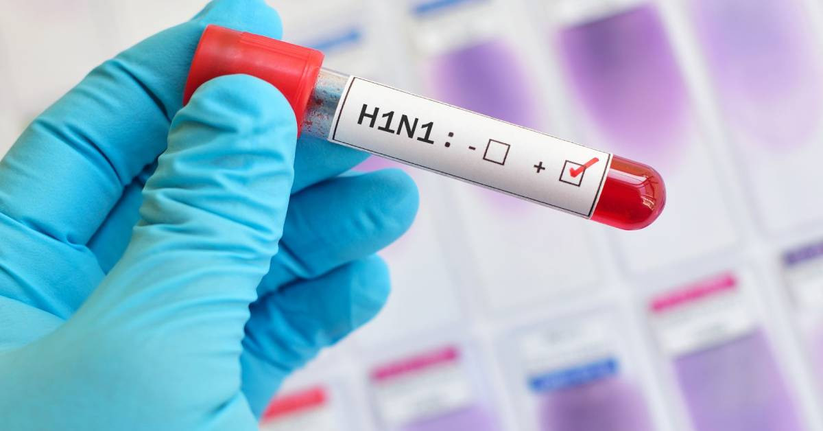 H1N1