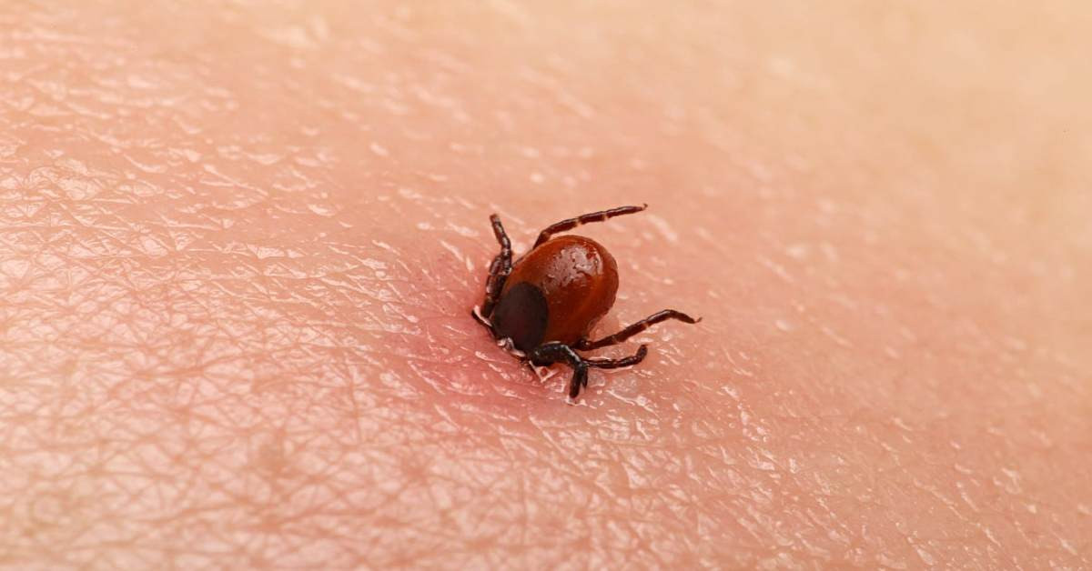 Lyme Hastalığı