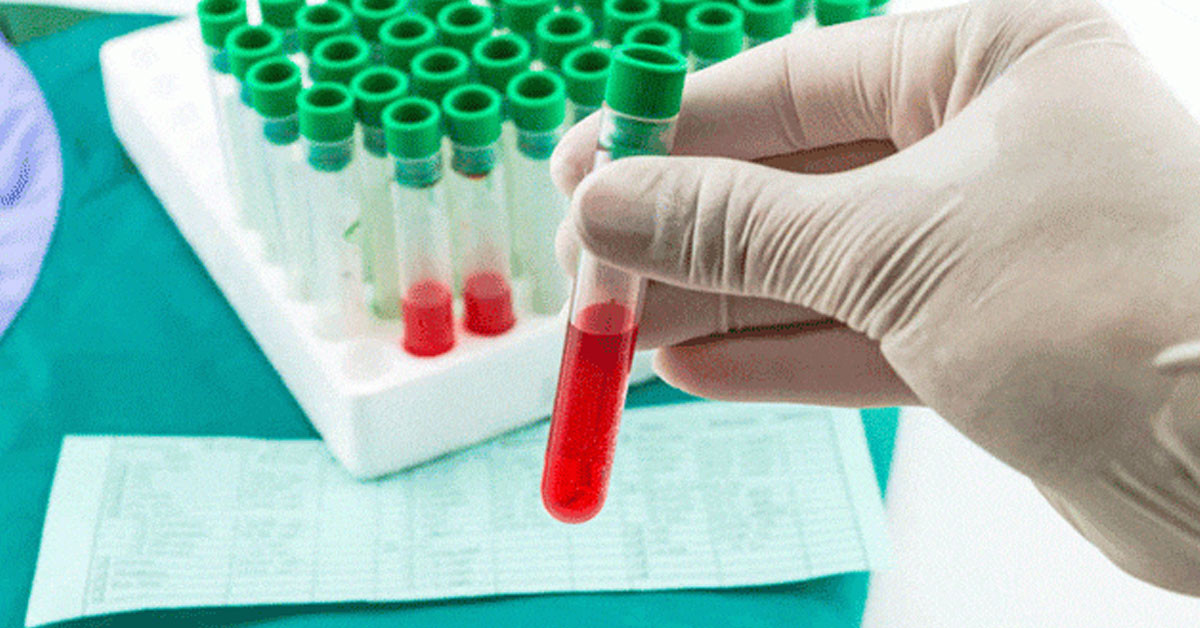 MHCH hangi hastalık belirtisidir? MHCH hangi hastalık belirtisidir?