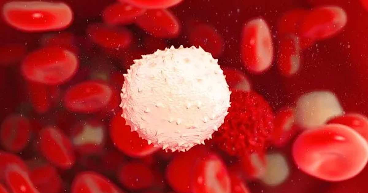 MHCH nedir? MHCH nedir?