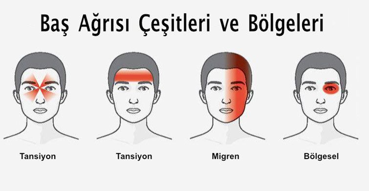 bas ağrısı bas ağrısı
