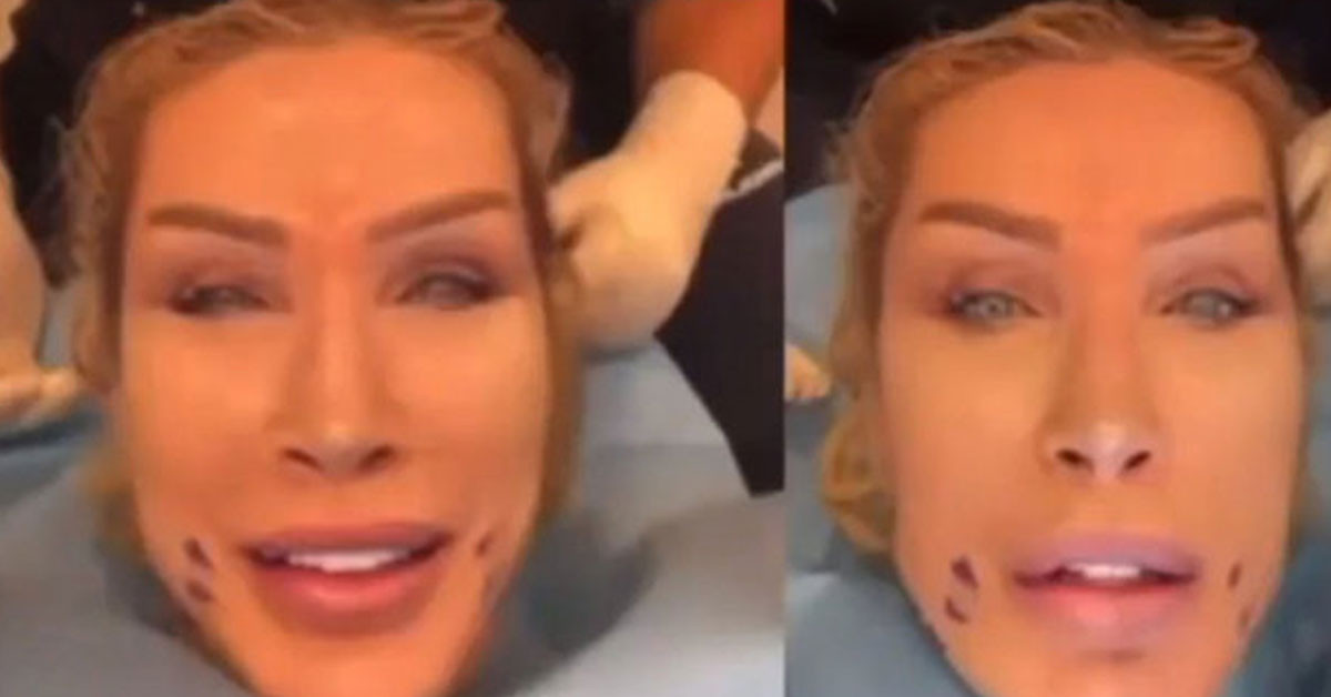 Seda Sayan deeplift yaptırdı