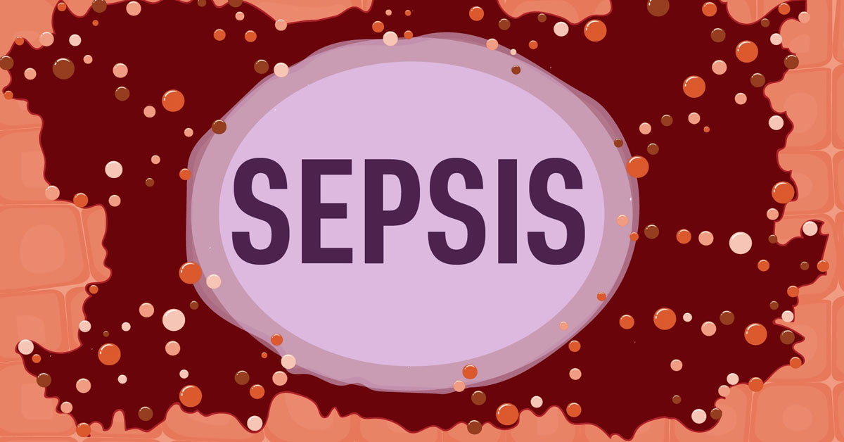 Sepsis kadını canından etti Sepsis kadını canından etti