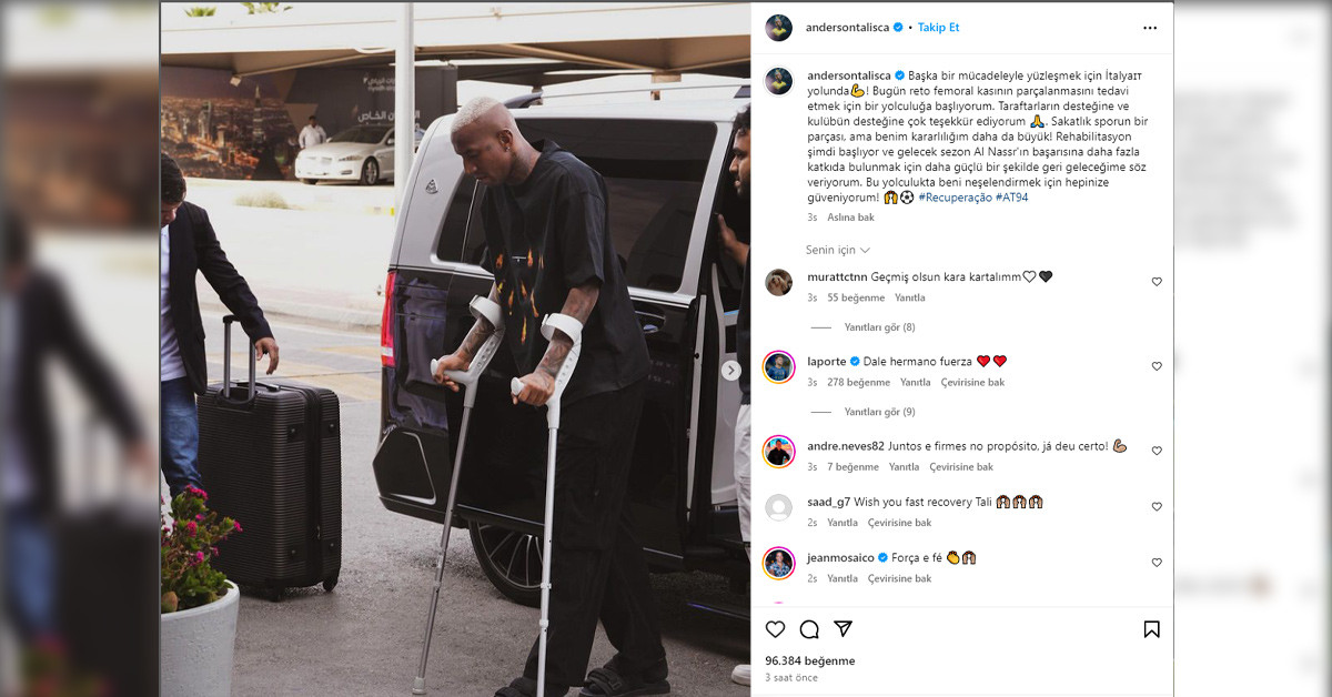 Talisca açıklama