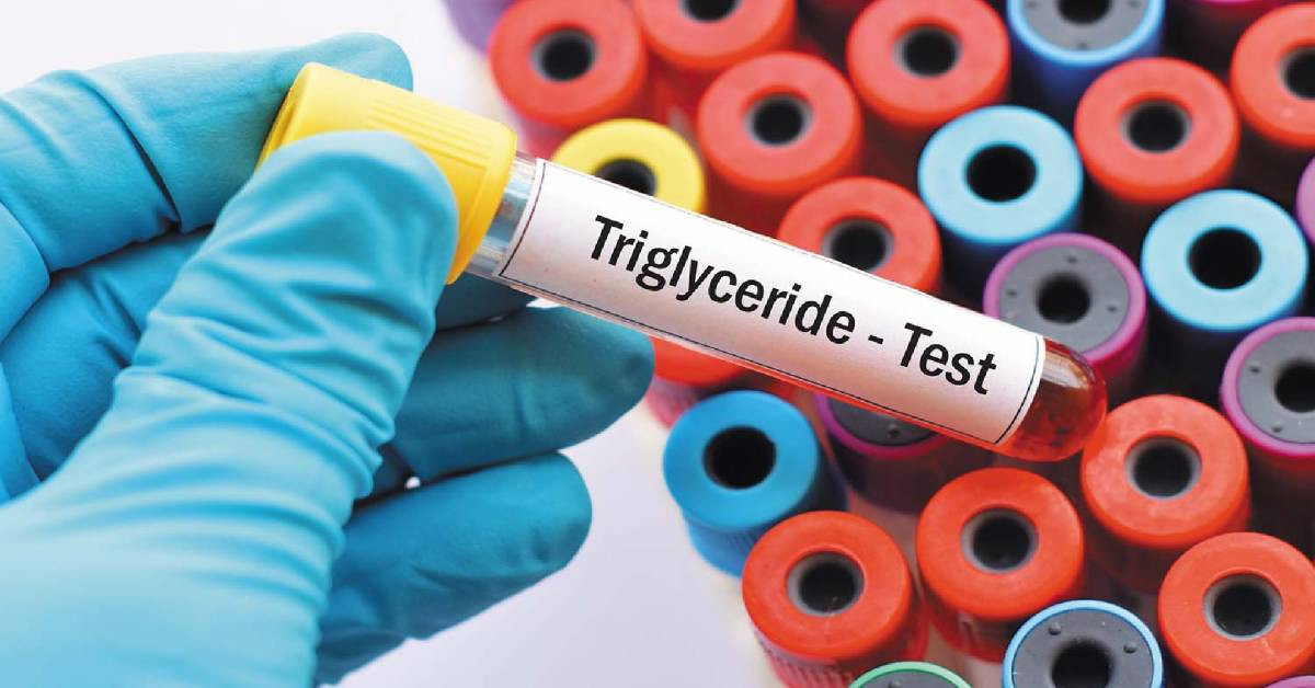 Trigliserid nedir, neden yükselir? Trigliserid belirtileri neler, nasıl düşürülür? Trigliserid tedavisi ve normal değeri