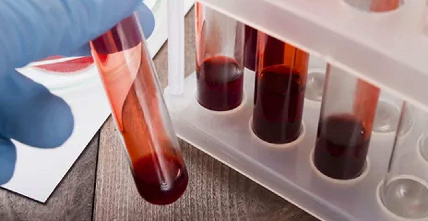 kreatin testi nedir
