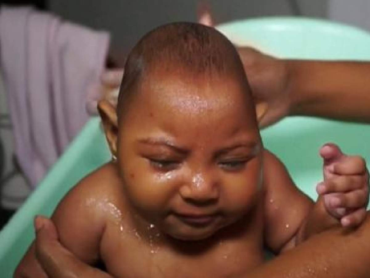 Zika virüsü Türkiye'de görüldü mü? Zika virüsü Türkiye'de görüldü mü?