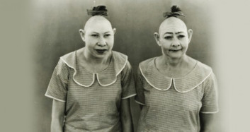 Süper Dişi Sendromu