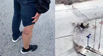 7 köpeğin arasında kaldı! Lise öğrencisinin hayatını güvenlik görevlisi kurtardı