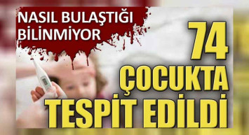 74 çocukta belirti gösteren gizemli hastalık nedir? Gizemli hastalık belirtileri nelerdir? Gizemli hastalık panik yaratmaya devam ediyor!